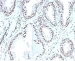 ATRX/RAD54 (Alpha Thalassemia Mental Retardation) Antibody in Immunohistochemistry (Paraffin) (IHC (P))