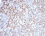 OCT-4 (POU5F1) (Germ Cell Tumor Marker) Antibody in Immunohistochemistry (Paraffin) (IHC (P))