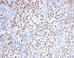 OCT-4 (POU5F1) (Germ Cell Tumor Marker) Antibody in Immunohistochemistry (Paraffin) (IHC (P))