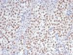 OCT-4 (POU5F1) (Germ Cell Tumor Marker) Antibody in Immunohistochemistry (Paraffin) (IHC (P))