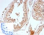 OCT-4 (POU5F1) (Germ Cell Tumor Marker) Antibody in Immunohistochemistry (Paraffin) (IHC (P))