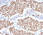 OCT-4 (POU5F1) (Germ Cell Tumor Marker) Antibody in Immunohistochemistry (Paraffin) (IHC (P))