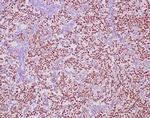 OCT-4 (POU5F1) (Germ Cell Tumor Marker) Antibody in Immunohistochemistry (Paraffin) (IHC (P))