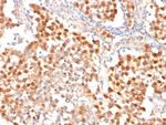 OCT-4 (POU5F1) (Germ Cell Tumor Marker) Antibody in Immunohistochemistry (Paraffin) (IHC (P))