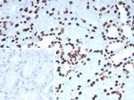 PET1/FEV Antibody in Immunohistochemistry (Paraffin) (IHC (P))