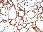 PET1/FEV Antibody in Immunohistochemistry (Paraffin) (IHC (P))