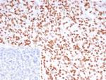 PET1/FEV Antibody in Immunohistochemistry (Paraffin) (IHC (P))