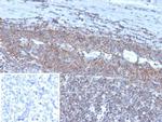 BCOR Antibody in Immunohistochemistry (Paraffin) (IHC (P))