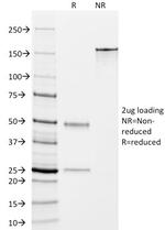 DOG-1/TMEM16A (Gastrointestinal Stromal Tumor Marker) Antibody in SDS-PAGE (SDS-PAGE)