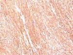 DOG-1/TMEM16A (Gastrointestinal Stromal Tumor Marker) Antibody in Immunohistochemistry (Paraffin) (IHC (P))