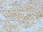 DOG-1/ANO1 (Marker for Gastrointestinal Stromal Tumors) Antibody in Immunohistochemistry (Paraffin) (IHC (P))