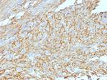 DOG-1/ANO1 (Marker for Gastrointestinal Stromal Tumors) Antibody in Immunohistochemistry (Paraffin) (IHC (P))