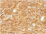 DOG-1/TMEM16A Antibody in Immunohistochemistry (Paraffin) (IHC (P))