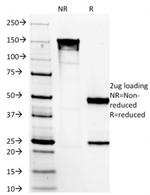 DOG-1/TMEM16A Antibody in SDS-PAGE (SDS-PAGE)