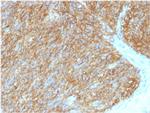 DOG-1/TMEM16A Antibody in Immunohistochemistry (Paraffin) (IHC (P))