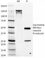 DOG-1/TMEM16A Antibody in SDS-PAGE (SDS-PAGE)