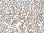 DOG-1/TMEM16A (Gastrointestinal Stromal Tumor Marker) Antibody in Immunohistochemistry (Paraffin) (IHC (P))