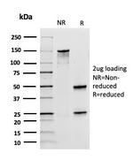 DOG-1/TMEM16A (Gastrointestinal Stromal Tumor Marker) Antibody in SDS-PAGE (SDS-PAGE)