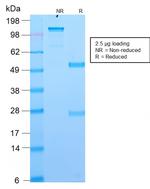 DOG-1/TMEM16A Antibody in SDS-PAGE (SDS-PAGE)