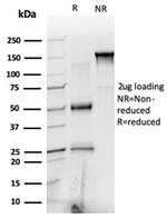 PRMT6 Antibody in SDS-PAGE (SDS-PAGE)