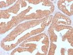 Calcineurin A/PPP3CA Antibody in Immunohistochemistry (Paraffin) (IHC (P))