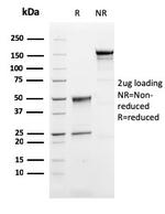 Perforin-1 (Pore Forming Protein) (Apoptosis Marker) Antibody in SDS-PAGE (SDS-PAGE)