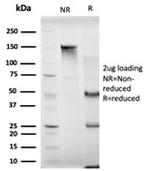 MBNL3 Antibody in SDS-PAGE (SDS-PAGE)