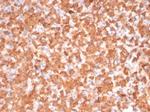 Protein Kinase C iota/lambda/PRKCI Antibody in Immunohistochemistry (Paraffin) (IHC (P))