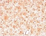 Protein Kinase C iota/lambda/PRKCI Antibody in Immunohistochemistry (Paraffin) (IHC (P))