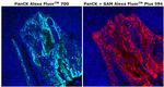 Pan Cytokeratin Antibody in Immunohistochemistry (Paraffin) (IHC (P))