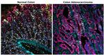 Pan Cytokeratin Antibody in Immunohistochemistry (Paraffin) (IHC (P))