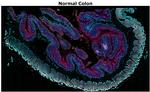 Pan Cytokeratin Antibody in Immunohistochemistry (Paraffin) (IHC (P))