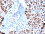 BARX1 Antibody in Immunohistochemistry (Paraffin) (IHC (P))