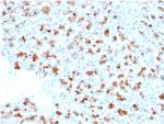 BARX1 Antibody in Immunohistochemistry (Paraffin) (IHC (P))