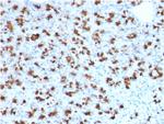 BARX1 (Prognostic Biomarker in Hepatocellular Carcinoma) Antibody in Immunohistochemistry (Paraffin) (IHC (P))