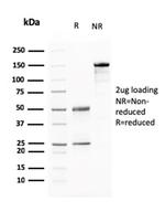 BARX1 (Prognostic Biomarker in Hepatocellular Carcinoma) Antibody in SDS-PAGE (SDS-PAGE)