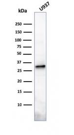 Prolactin Antibody in Western Blot (WB)