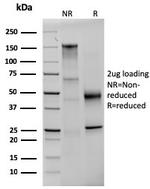 Prolactin (Pituitary Tumor Marker) Antibody in SDS-PAGE (SDS-PAGE)