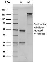 Prolactin (Pituitary Tumor Marker) Antibody in SDS-PAGE (SDS-PAGE)