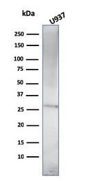 Prolactin (Pituitary Tumor Marker) Antibody in Western Blot (WB)