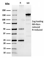 Prolactin (Pituitary Tumor Marker) Antibody in SDS-PAGE (SDS-PAGE)