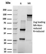 Prolactin (Pituitary Tumor Marker) Antibody in SDS-PAGE (SDS-PAGE)