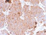 Prolactin (Pituitary Tumor Marker) Antibody in Immunohistochemistry (Paraffin) (IHC (P))