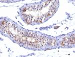 Prolactin Receptor (hPRL Receptor) Antibody in Immunohistochemistry (Paraffin) (IHC (P))