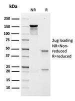 Prolactin Receptor (hPRL Receptor) Antibody in SDS-PAGE (SDS-PAGE)