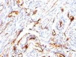 Beta-2 Microglobulin Antibody in Immunohistochemistry (Paraffin) (IHC (P))