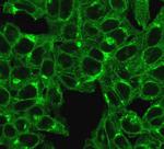 Beta-2 Microglobulin (Renal Failure and Tumor Marker) Antibody in Immunocytochemistry (ICC/IF)