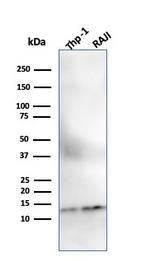 Beta-2 Microglobulin (Renal Failure and Tumor Marker) Antibody in Western Blot (WB)