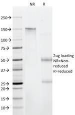 Beta-2 Microglobulin (Renal Failure and Tumor Marker) Antibody in SDS-PAGE (SDS-PAGE)