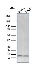 Beta-2 Microglobulin (Renal Failure and Tumor Marker) Antibody in Western Blot (WB)